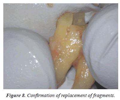 clinical-dentistry-replacement-fragments