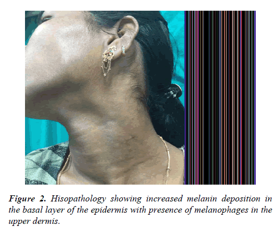 clinical-dermatology-Hisopathology