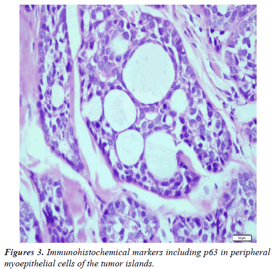 clinical-dermatology-Immunohistochemical