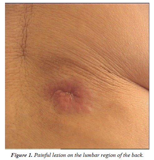 clinical-dermatology-Painful-lesion