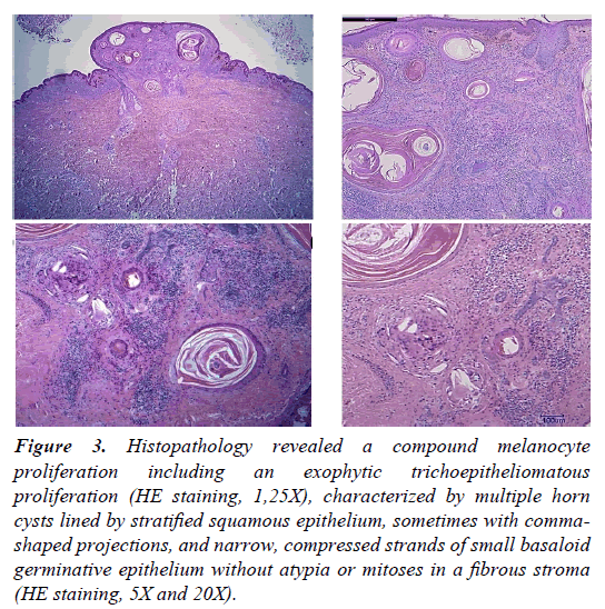 clinical-dermatology-brown-Histopathology