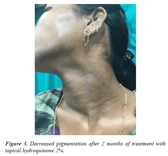 clinical-dermatology-pigmentation