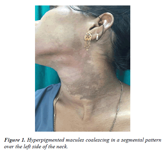 clinical-dermatology-segmental-pattern