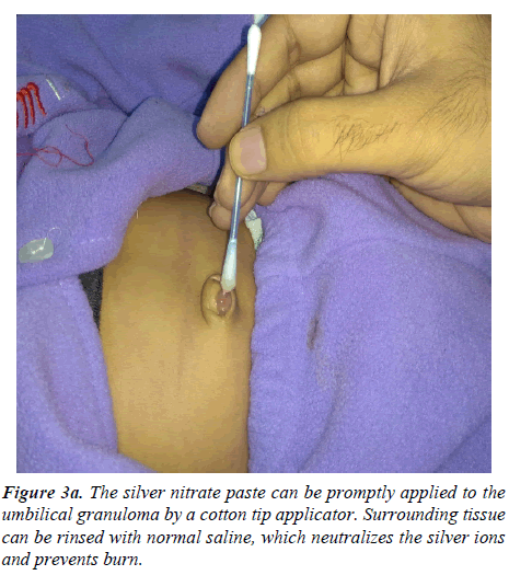 clinical-dermatology-tip-applicator