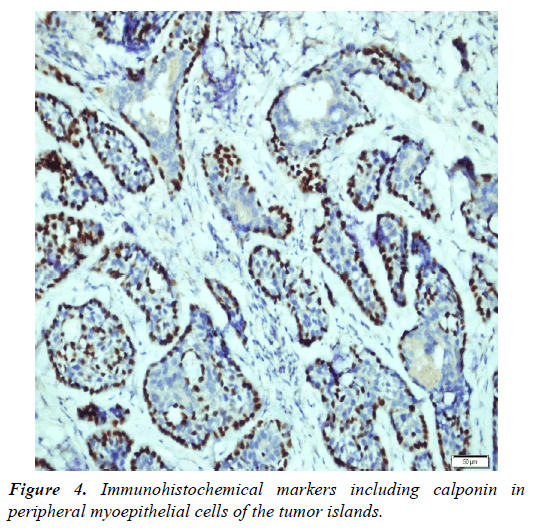 clinical-dermatology-tumor-islands