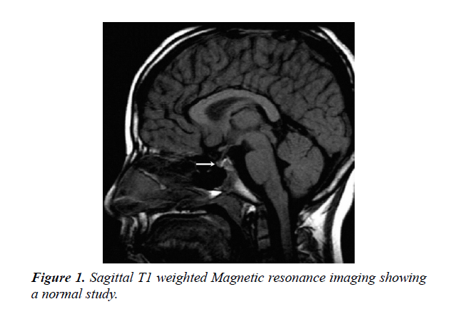 clinical-endocrionology-research-sagittal-T1