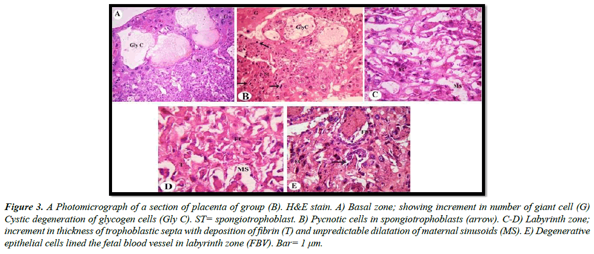 clinical-experimental-toxicology-trophoblastic-septa