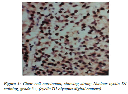 clinical-oncology-Clear-cell