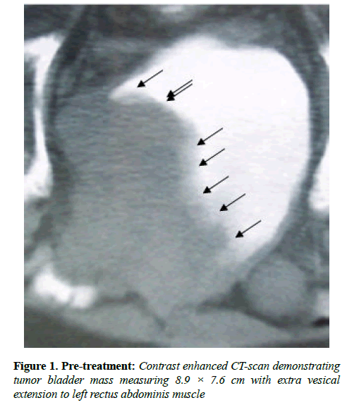 clinical-oncology-Contrast-enhanced