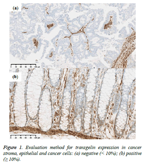 clinical-oncology-Evaluation-method