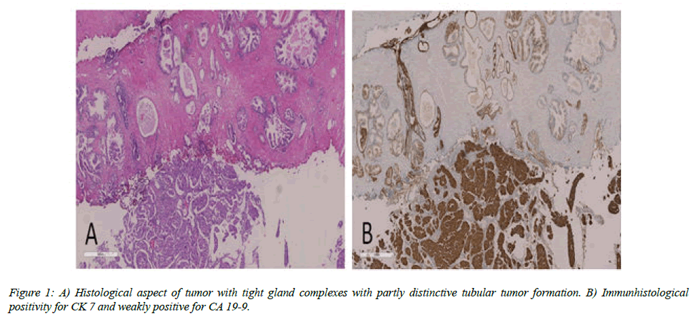 clinical-oncology-Histological-aspect