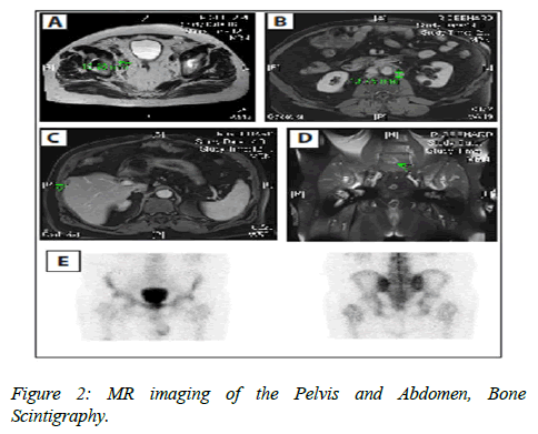 clinical-oncology-MR-imaging