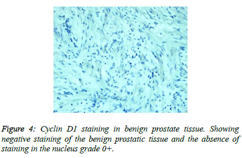 clinical-oncology-benign-prostate