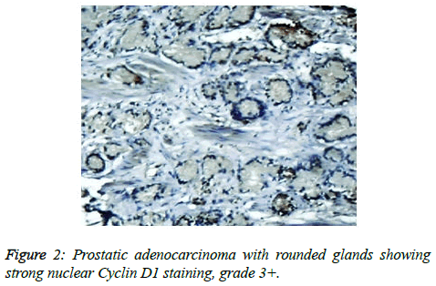 clinical-oncology-rounded-glands