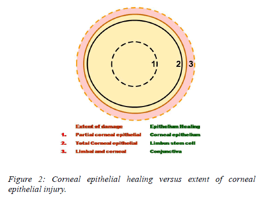 clinical-ophthalmology-epithelial-injury