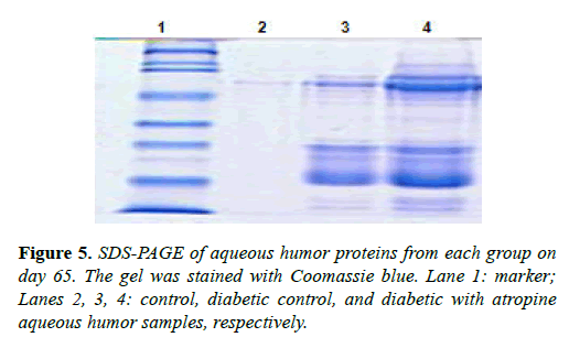 clinical-ophthalmology-humor-proteins