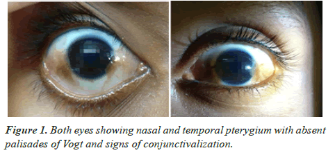 clinical-ophthalmology-nasal