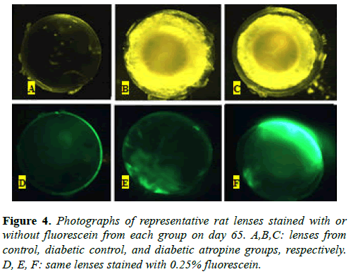 clinical-ophthalmology-science-diabetic