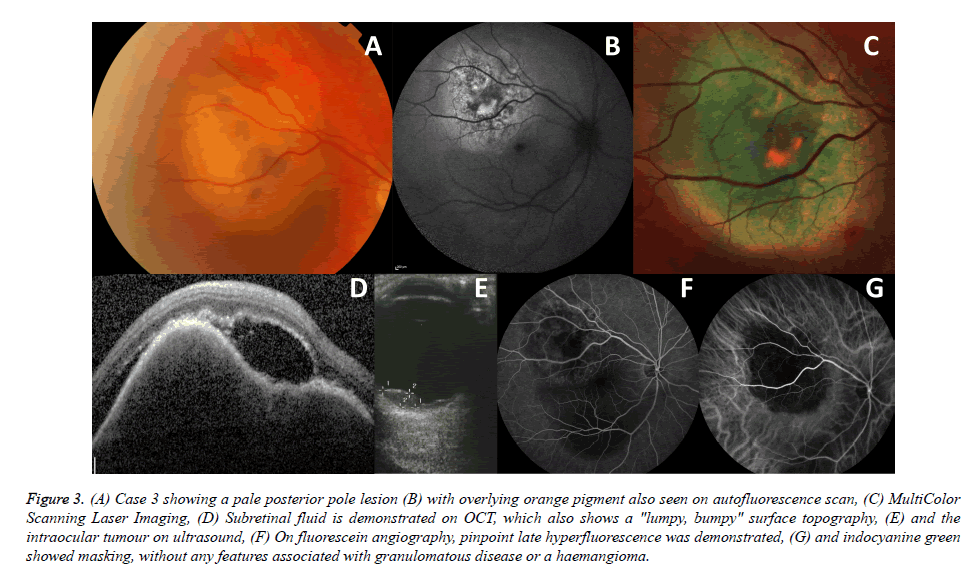 clinical-ophthalmology-surface-topography