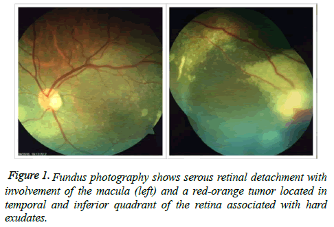 clinical-ophthalmology-vision-Fundus-photography