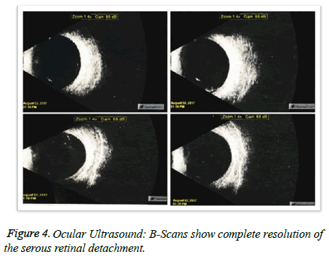 clinical-ophthalmology-vision-complete-resolution