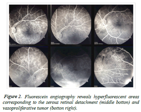 clinical-ophthalmology-vision-middle-botton