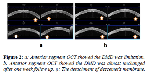 clinical-ophthalmology-vision-science-Anterior-segment