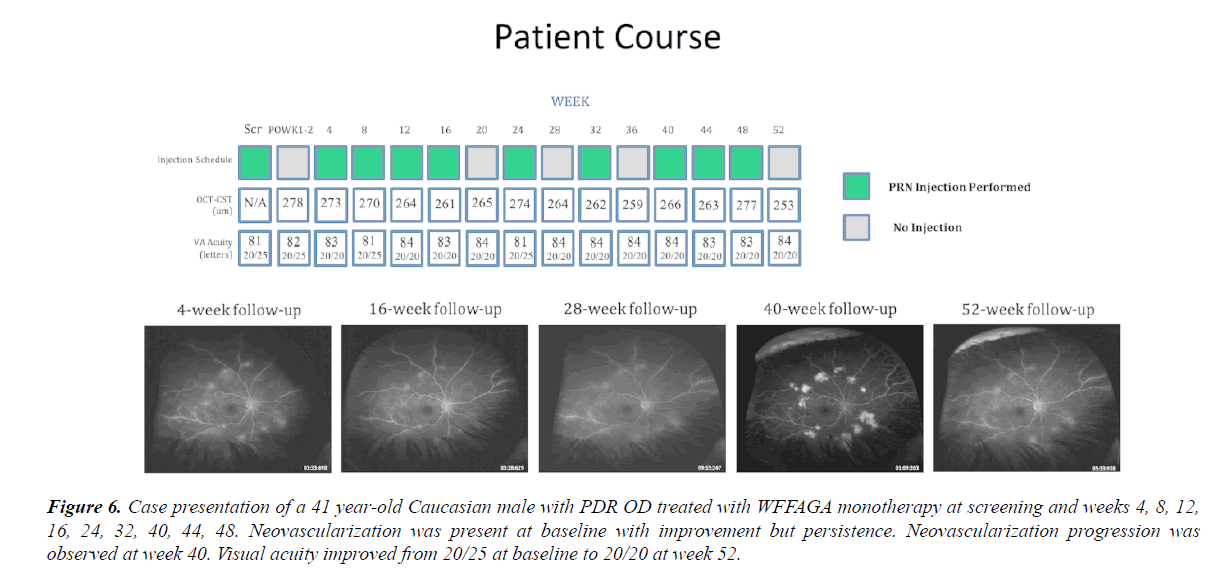 clinical-ophthalmology-vision-science-Caucasian