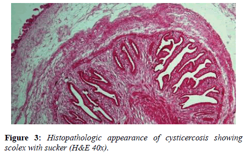 clinical-ophthalmology-vision-science-Histopathologic-appearance