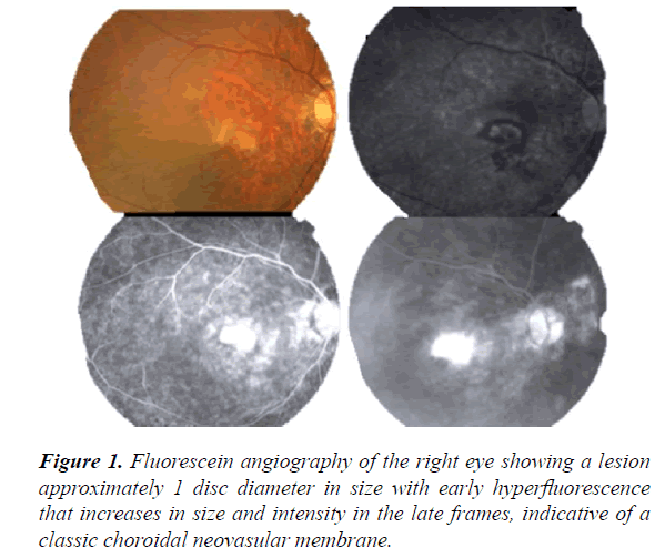 clinical-ophthalmology-vision-science-angiography