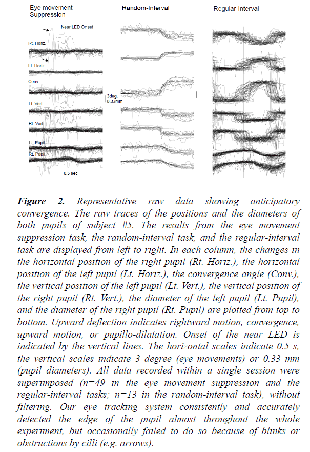 clinical-ophthalmology-vision-science-anticipatory