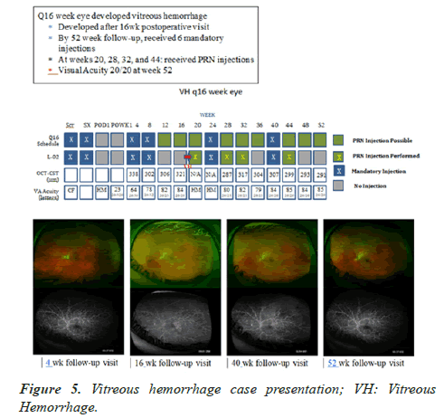 clinical-ophthalmology-vision-science-case