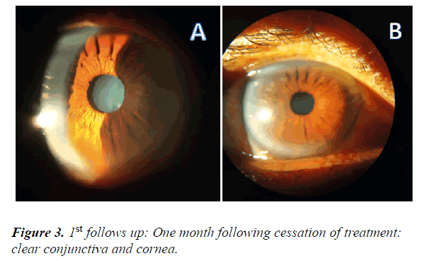 clinical-ophthalmology-vision-science-cessation