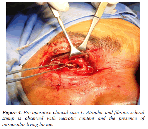 clinical-ophthalmology-vision-science-clinical