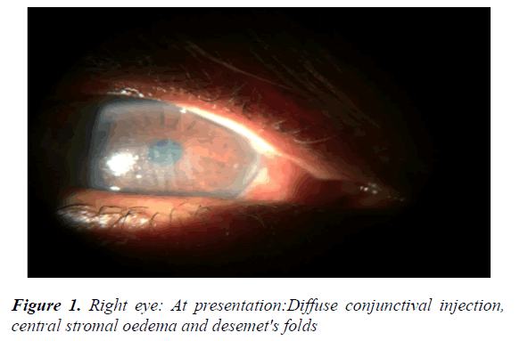 clinical-ophthalmology-vision-science-conjunctival