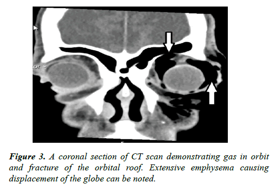 clinical-ophthalmology-vision-science-demonstrating