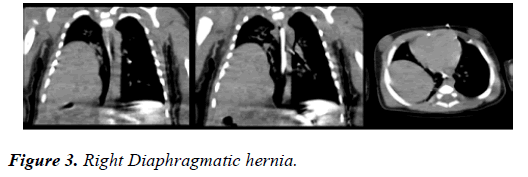 clinical-ophthalmology-vision-science-diaphragmatic