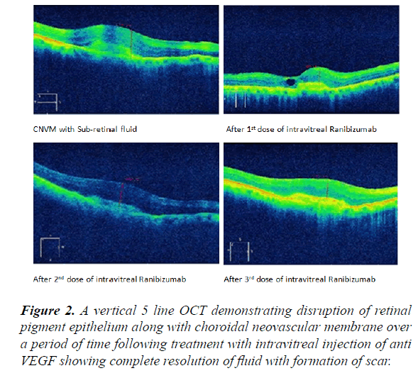 clinical-ophthalmology-vision-science-disruption