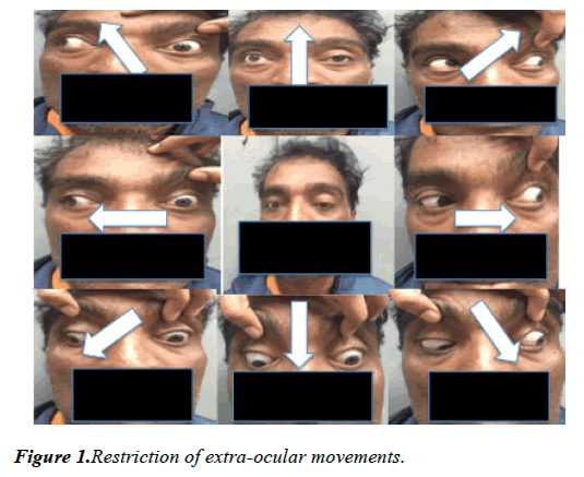 clinical-ophthalmology-vision-science-extra