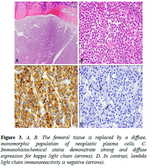 clinical-ophthalmology-vision-science-femoral-tissue