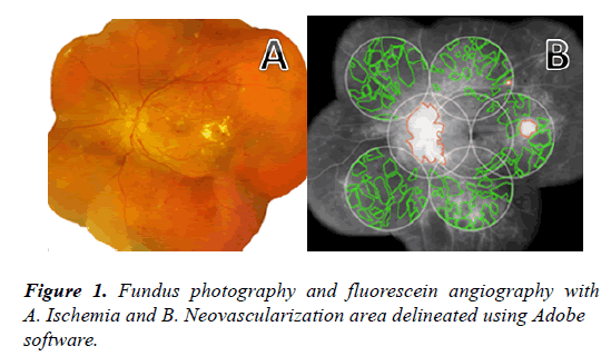 clinical-ophthalmology-vision-science-fluorescein
