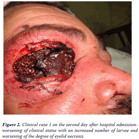 clinical-ophthalmology-vision-science-hospital