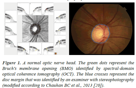 clinical-ophthalmology-vision-science-identified