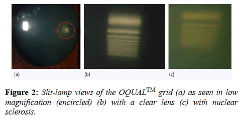 clinical-ophthalmology-vision-science-lamp-views