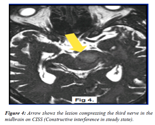 clinical-ophthalmology-vision-science-lesion