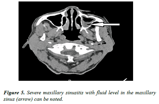 clinical-ophthalmology-vision-science-maxillary