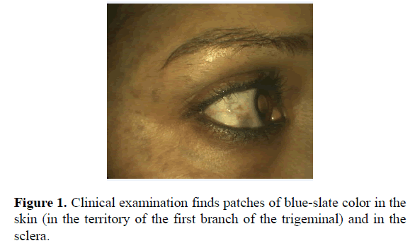 clinical-ophthalmology-vision-science-patches