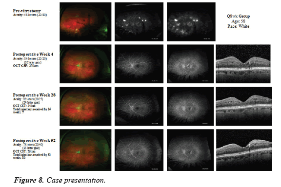 clinical-ophthalmology-vision-science-presentation