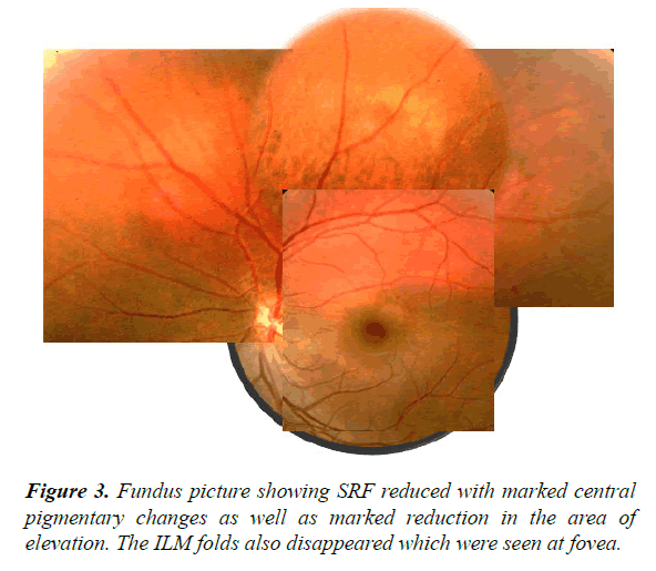 clinical-ophthalmology-vision-science-reduced