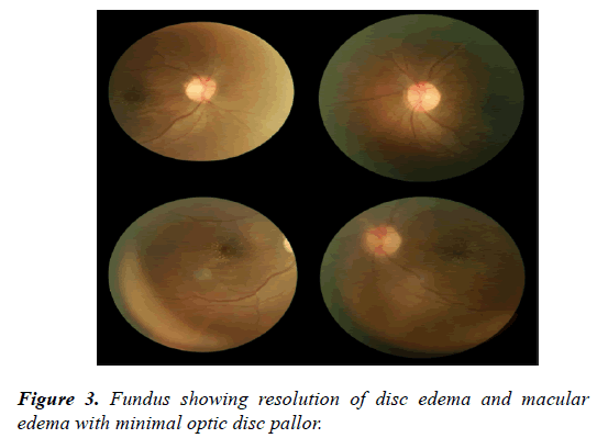 clinical-ophthalmology-vision-science-resolution